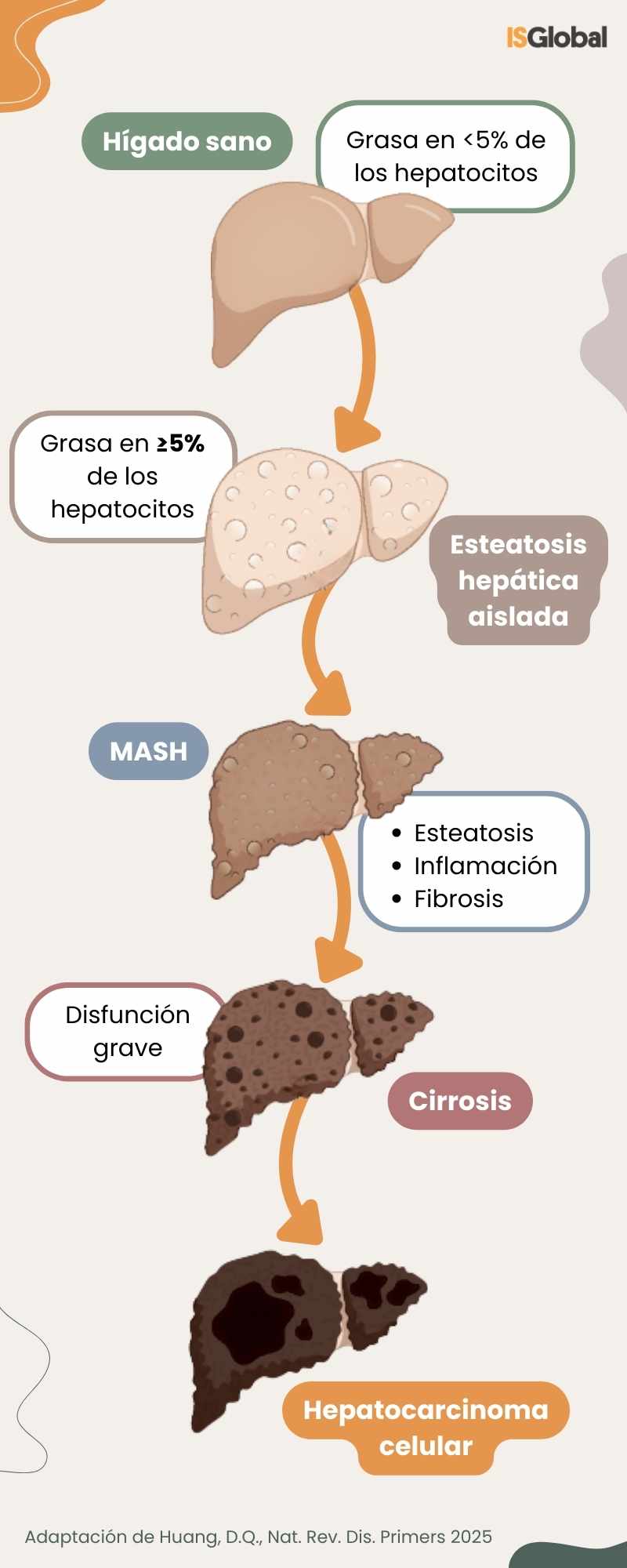 La progresión de la esteatosis hepática metabólica (MASLD)