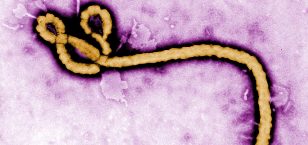 The Most Feared Pathogens: 9 Diseases that Could Cause a Major Epidemic