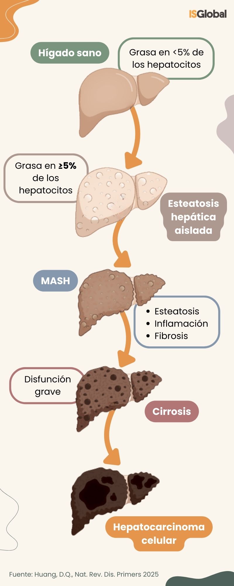 La progresión de la esteatosis hepática metabólica (MASLD)