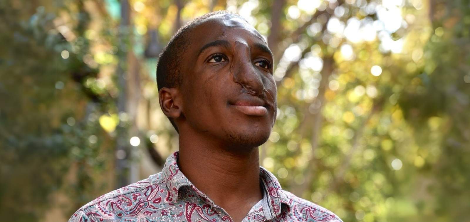 Entrevista a Valter Muendane | Superviviente del noma