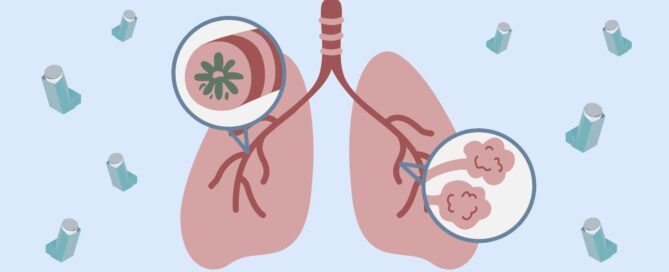 Iconos que representan la EPOC; en el centro, unos pulmones con bronquitis crónica y enfisema. Alrededor, inhaladores.