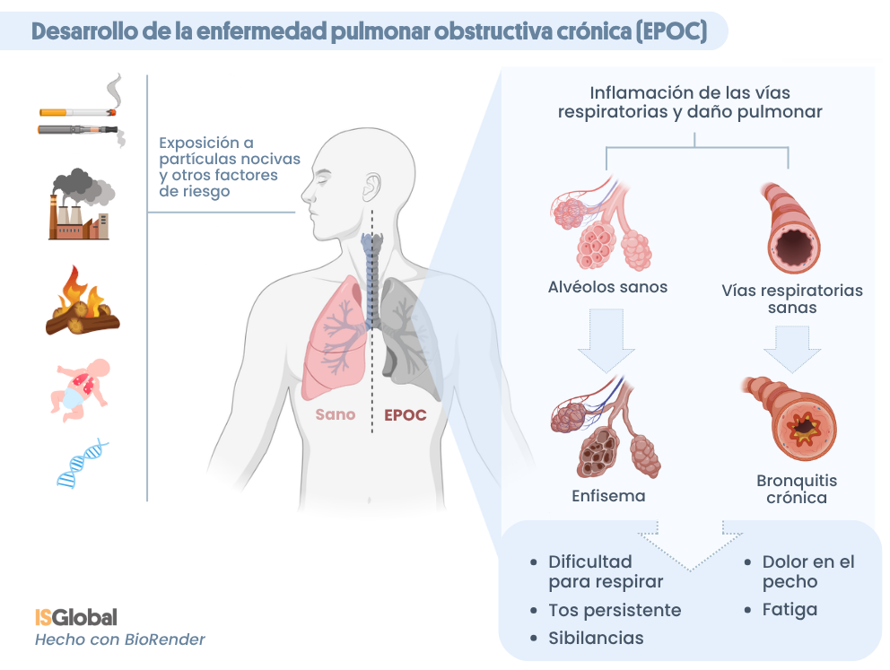 Desarrollo de la EPOC. Infografía que muestra los factores de riesgo (fumar, contaminación y exposición a tóxicos, humo, infecciones respiratorias en la infancia y alteraciones genéticas), y la comparación entre alveolos y vías respiratorias sanas (pulmón sano) y enfisema y bronquitis crónica (EPOC).