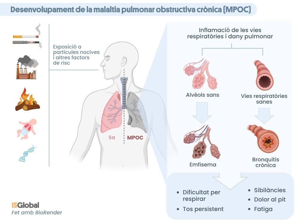Desenvolupament de la MPOC. Infografia que mostra els factors de risc (fumar, contaminació i exposició a tòxics, fum, infeccions respiratòries a la infància i alteracions genètiques), i la comparació entre alvèols i vies respiratòries sanes (pulmó sa) i emfisema i bronquitis crònica (MPOC).